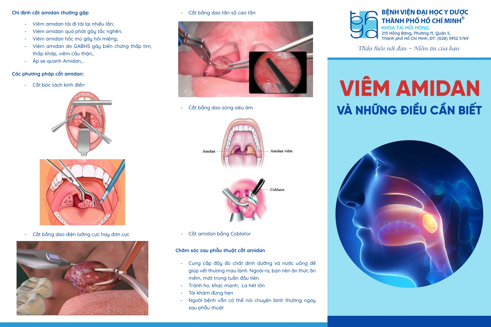 to roi viem amidan va nhung dieu can biet_1.webp